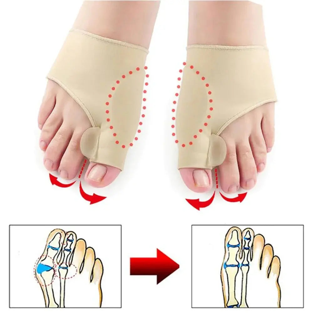 1 paar Toe Separator Hallux Valgus Bunion Corrector Hammer Kappe Haarglätter Fuß Schmerzen Relief Orthopädische Pediküre Werkzeuge Fuß Pflege J&M Cheap Store